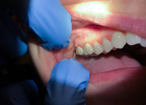 Best Tooth Pain Emergency Relief  in Wheaton, MD